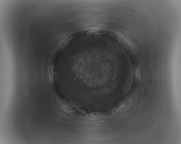 X0000111420868200907201046