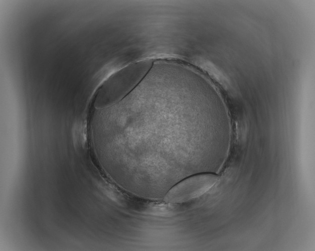 X0000111421165200907201042