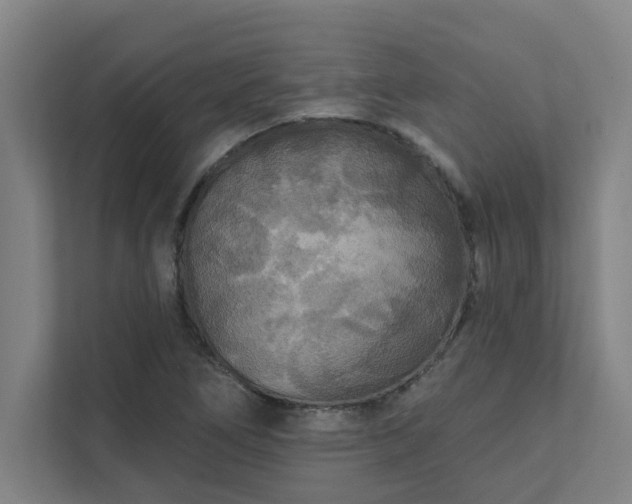 X0000111421266200907201040