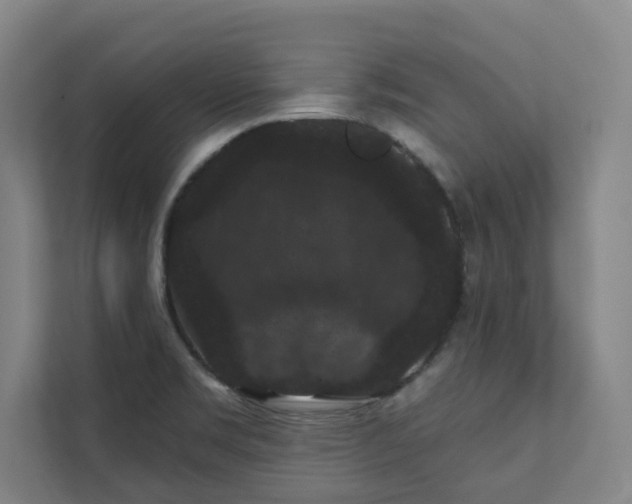 X0000111421469200907201038