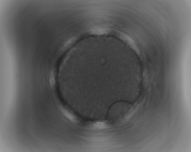 X0000111420114200907271151