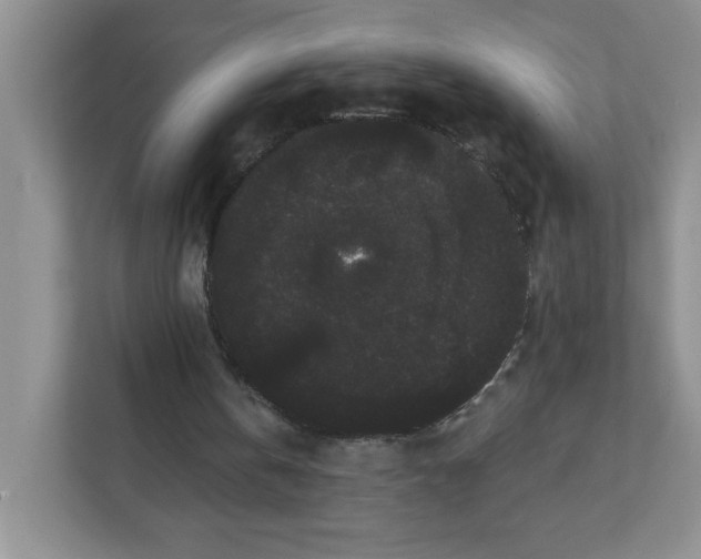 X0000111420146200907271150