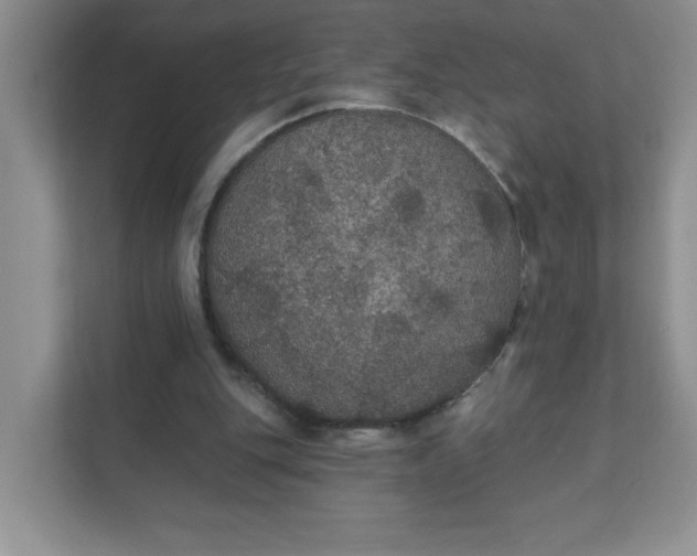 X0000111420151200907271150