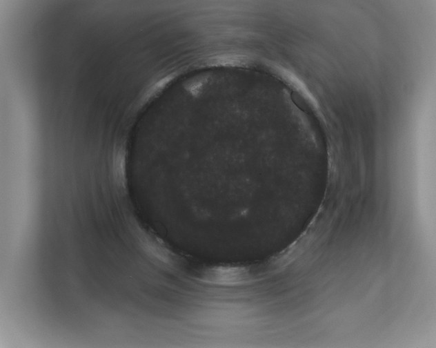 X0000111420154200907271150