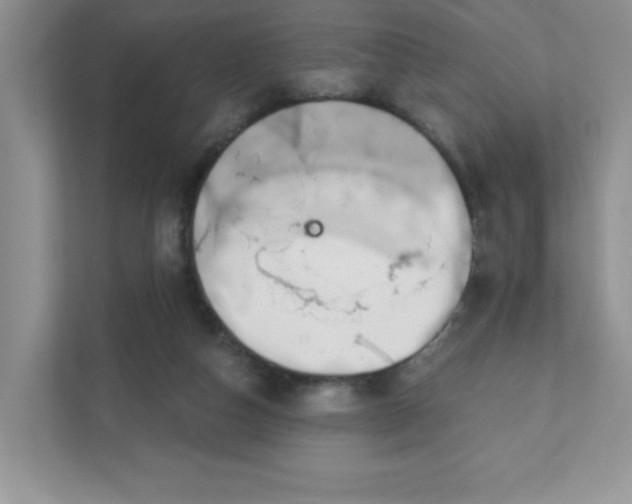 X0000111420162200907271150