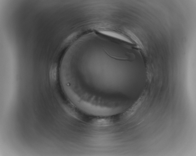 X0000111420163200907271150