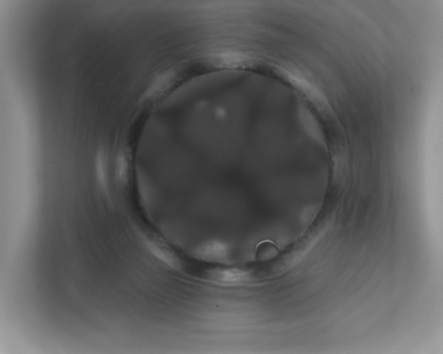 X0000111420165200907271150