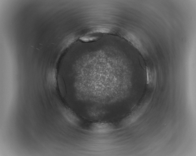 X0000111420300200907271149