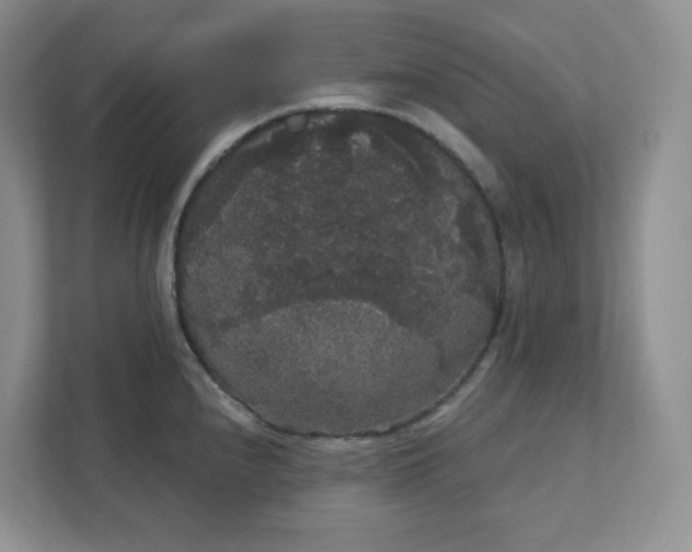 X0000111421240200907271136