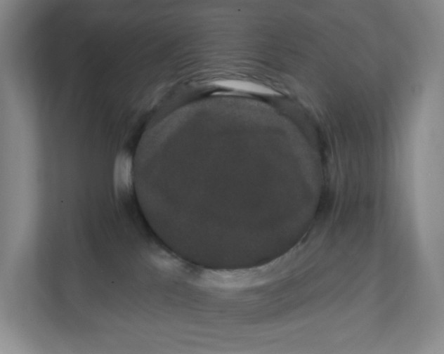 X0000111420041200908031314