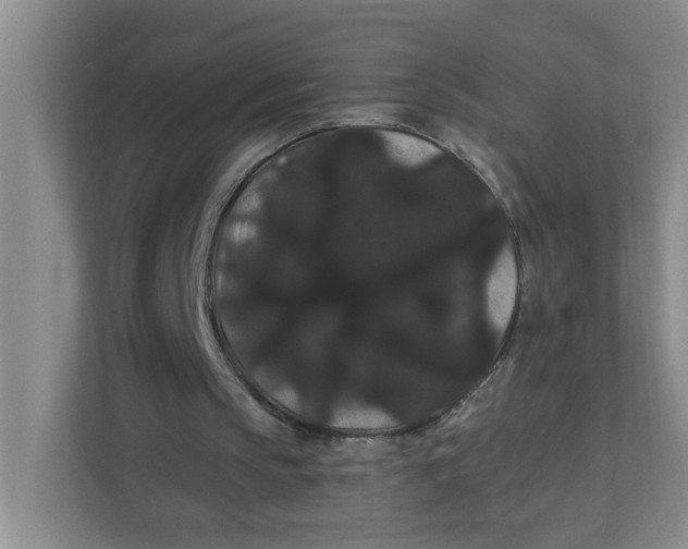 X0000111420145200908031312
