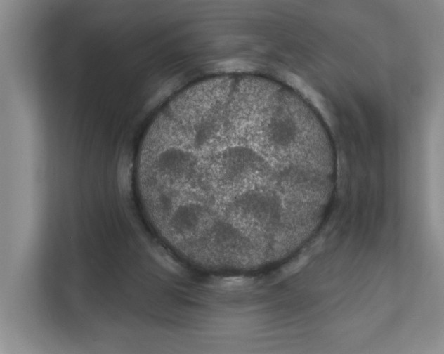 X0000111420153200908031312