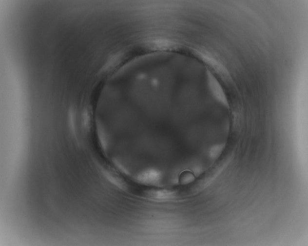 X0000111420165200908031312