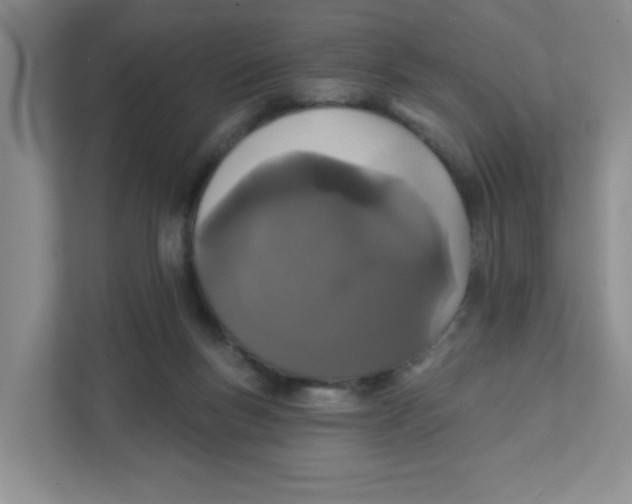 X0000111420167200908031312