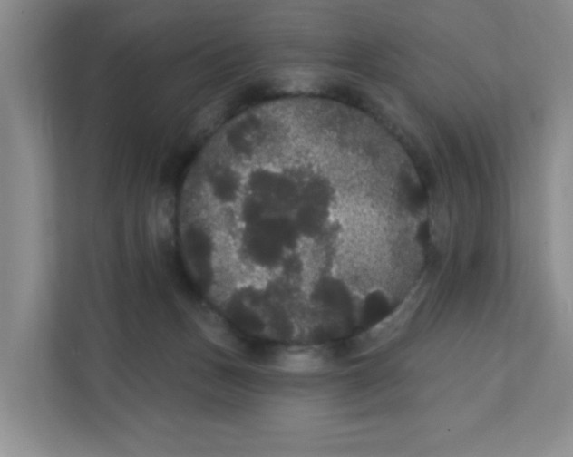 X0000111420175200908031312