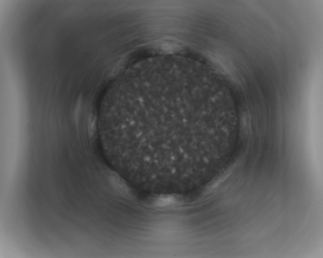 X0000111420177200908031312