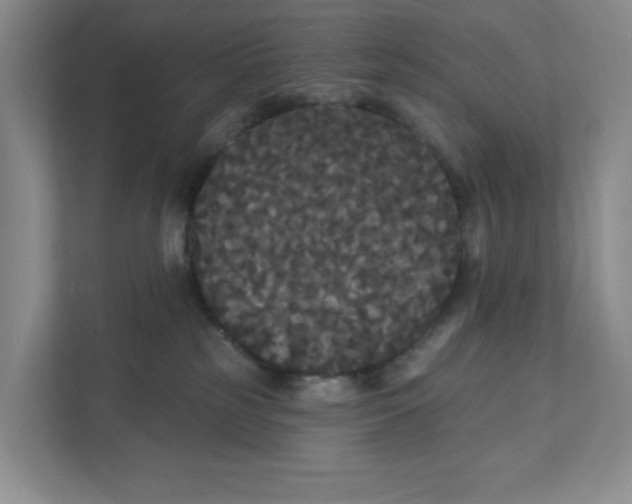 X0000111420185200908031312