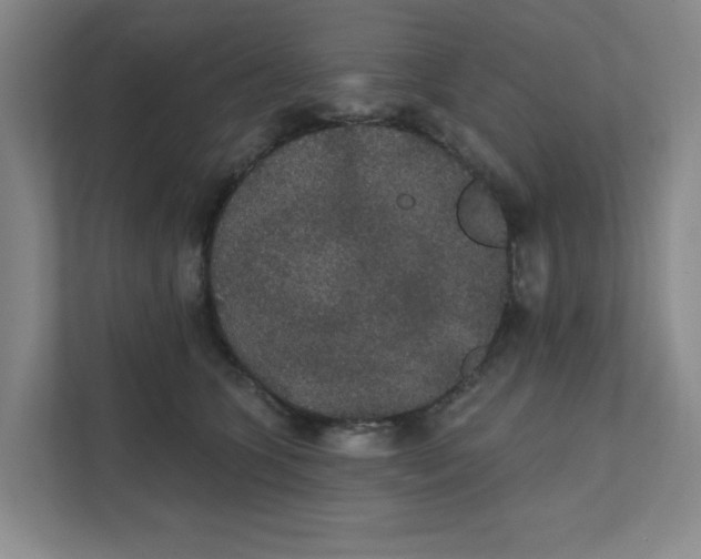 X0000111420563200908031307