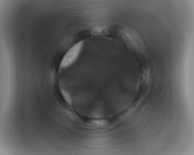 X0000111420659200908031306