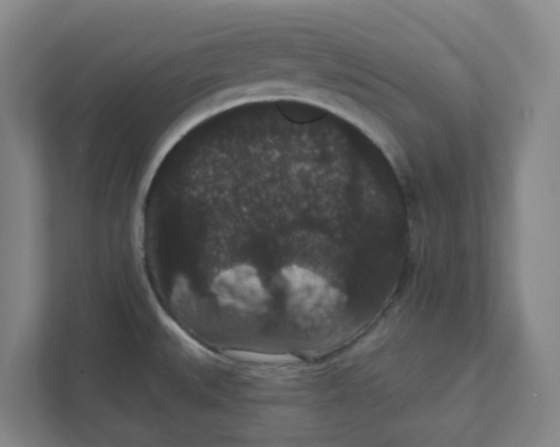 X0000111421527200908031255