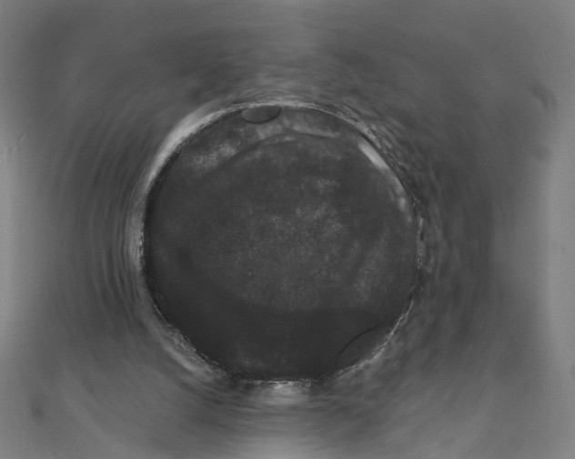 X0000111420056200908101104