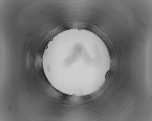 X0000111420142200908101103
