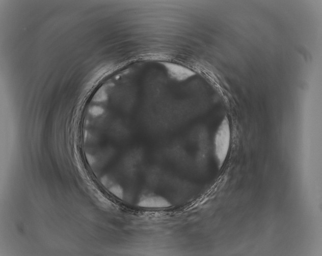 X0000111420145200908101103