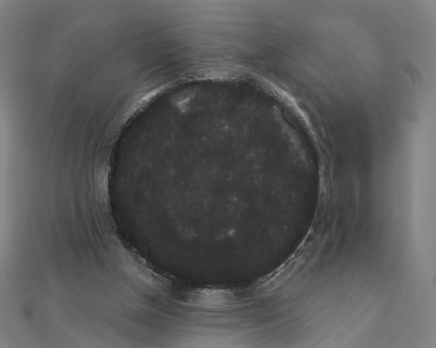 X0000111420154200908101103