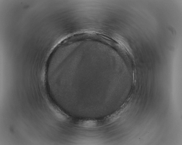 X0000111420156200908101103