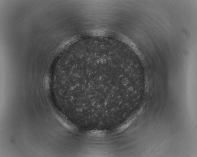 X0000111420161200908101103