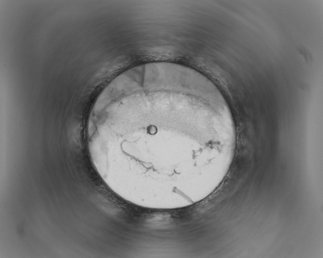 X0000111420162200908101103
