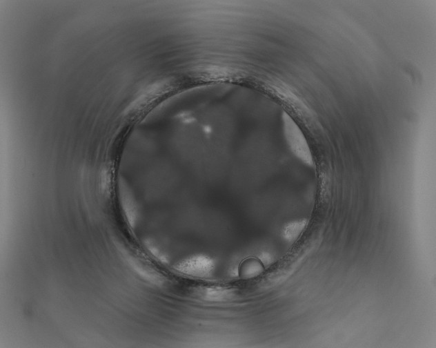 X0000111420165200908101103