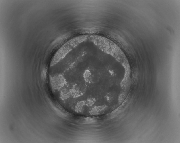 X0000111420166200908101103