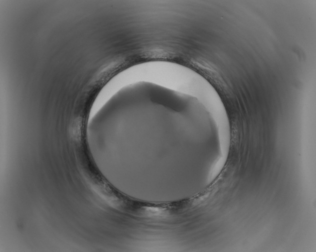 X0000111420167200908101103