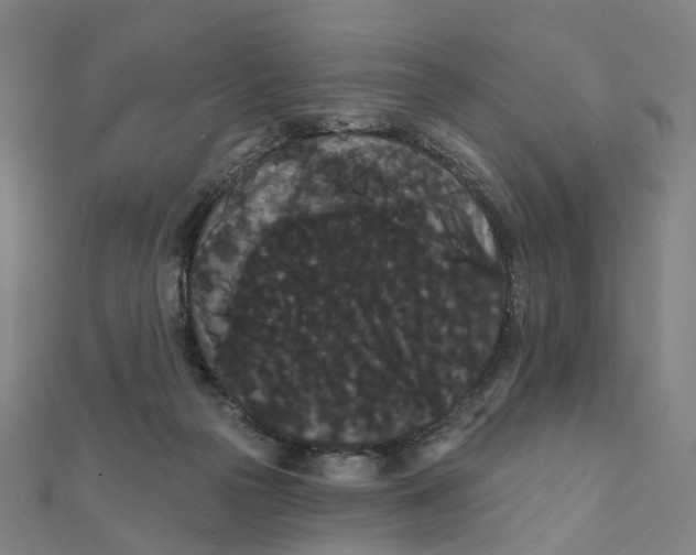 X0000111420169200908101103