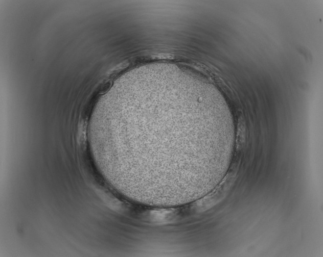 X0000111420172200908101103