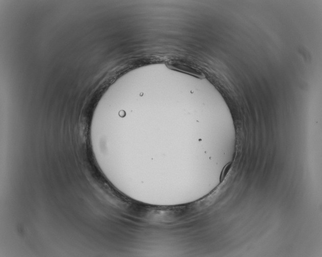 X0000111420174200908101103