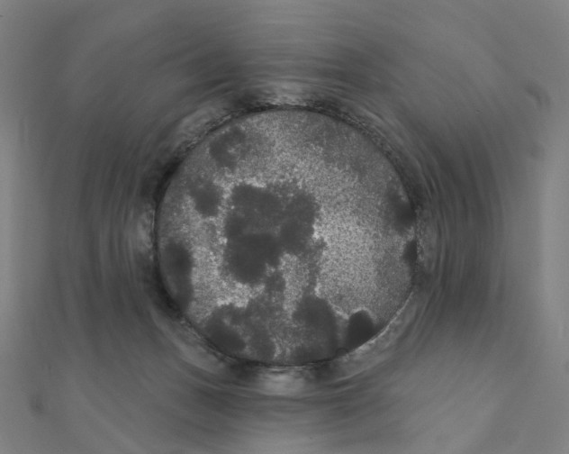X0000111420175200908101103
