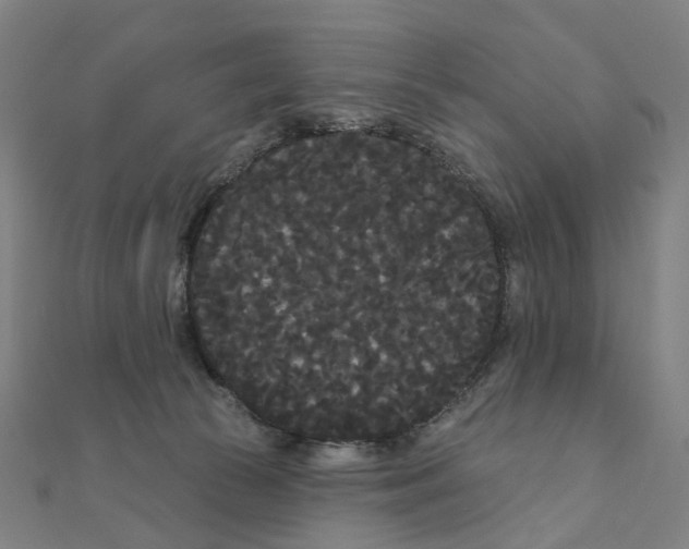 X0000111420177200908101103