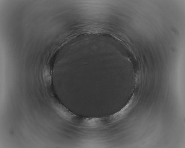 X0000111420186200908101103