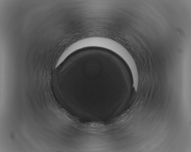 X0000111420223200908101102