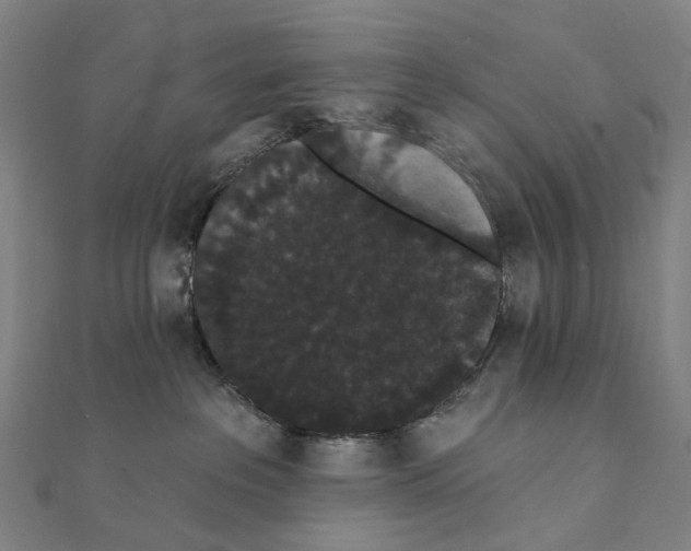 X0000111420237200908101102