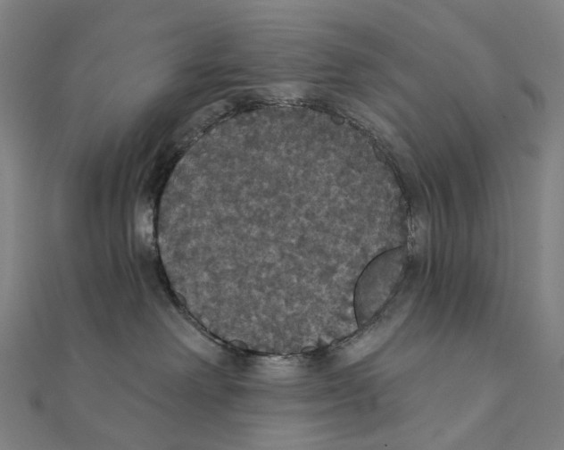 X0000111420238200908101102