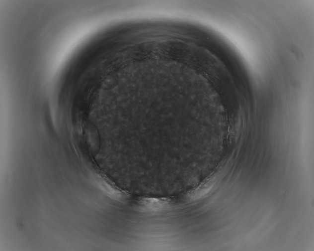 X0000111420239200908101102