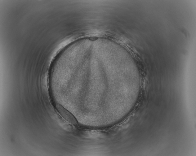X0000111420244200908101101
