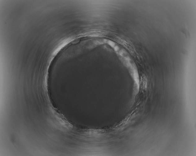 X0000111420292200908101101