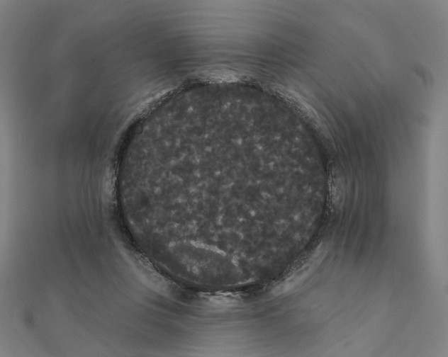 X0000111420359200908101100