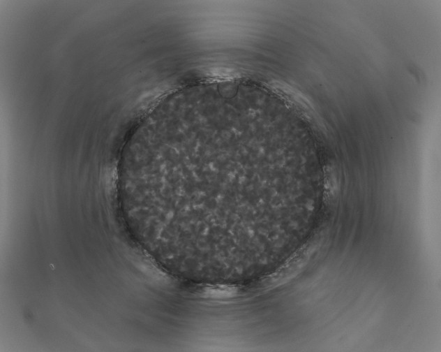 X0000111420369200908101100