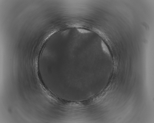 X0000111420386200908101100