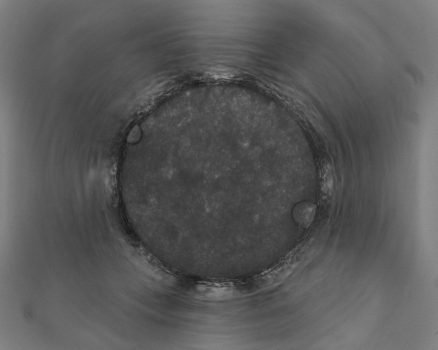 X0000111420559200908101058